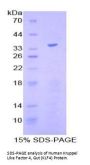 Human Krueppel-Like Factor 4 (KLF4) Protein
