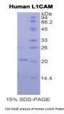 Human L1-Cell Adhesion Molecule (L1CAM) Protein