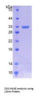 Human Lactate Dehydrogenase A (LDHA) Protein