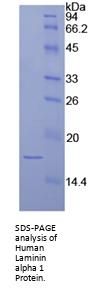 Human Laminin Subunit Alpha 1 (LAMA1) Protein