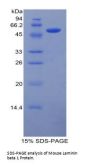 Mouse Laminin Beta 1 (LAMb1) Protein