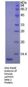Mouse Laminin Beta 2 (LAMb2) Protein