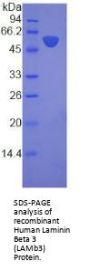 Human Laminin Beta 3 (LAMb3) Protein