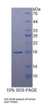 Human Lecithin Cholesterol Acyltransferase (LCAT) Protein
