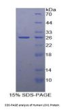 Human Oxidized Low Density Lipoprotein Receptor 1 (OLR1) Protein