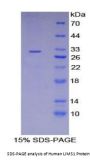 Human LIM And Senescent Cell Antigen Like Domains Protein 1 (LIMS1) Protein