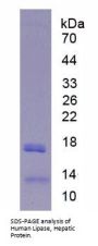 Human Lipase, Hepatic (LIPC) Protein