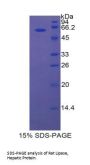 Rat Lipase, Hepatic (LIPC) Protein