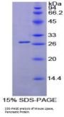 Mouse Lipase, Pancreatic (PL) Protein