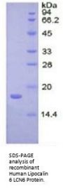 Human Lipocalin 6 (LCN6) Protein