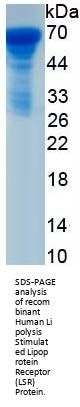 Human Lipolysis Stimulated Lipoprotein Receptor (LSR) Protein