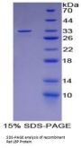 Rat Lipopolysaccharide Binding Protein (LBP) Protein