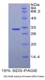 Human Low Density Lipoprotein Receptor Related Protein 5 Like Protein (LRP5L) Protein
