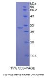 Human Low Density Lipoprotein Receptor Related Protein Associated Protein 1 (LRPAP1) Protein