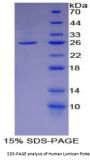 Human Lumican (LUM) Protein