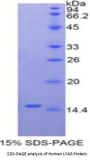 Human Ly1 Antibody Reactive Homolog (LYAR) Protein