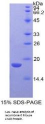 Mouse Ly1 Antibody Reactive Homolog (LYAR) Protein