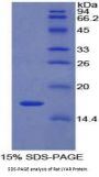 Rat Ly1 Antibody Reactive Homolog (LYAR) Protein