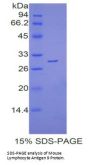 Mouse Lymphocyte Antigen 9 (LY9) Protein