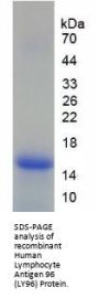 Human Lymphocyte Antigen 96 (LY96) Protein