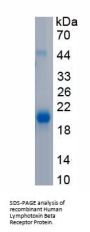 Human Lymphotoxin Beta Receptor (LTbR) Protein