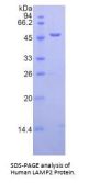 Human Lysosomal Associated Membrane Protein 2 (LAMP2) Protein