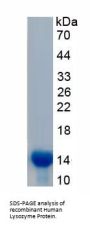 Human Lysozyme (LZM) Protein
