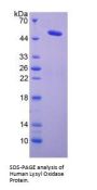 Human Lysyl Oxidase (LOX) Protein