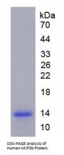 Human C-C Motif Chemokine 19 (CCL19) Protein