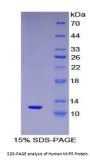 Human Macrophage Inflammatory Protein 5 (MIP5) Protein