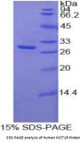 Human Macrophage Stimulating 1 Receptor (MST1R) Protein