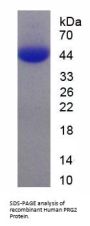Human Bone Marrow Proteoglycan (PRG2) Protein