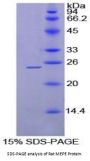 Rat Matrix Extracellular Phosphoglycoprotein (MEPE) Protein