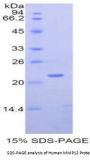 Human Matrix Metalloproteinase 12 (MMP12) Protein