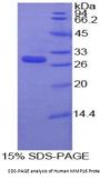 Human Matrix Metalloproteinase 16 (MMP16) Protein