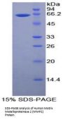 Human Matrix Metalloproteinase 2 (MMP2) Protein