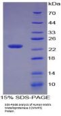 Human Matrix Metalloproteinase 3 / Stromelysin-1 (MMP3) Protein