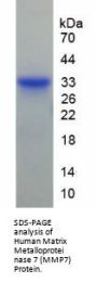 Human Matrix Metalloproteinase 7 (MMP7) Protein