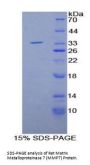 Rat Matrix Metalloproteinase 7 (MMP7) Protein