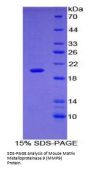 Mouse Matrix Metalloproteinase 9 (MMP9) Protein