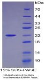 Cow Matrix Metalloproteinase 9 (MMP9) Protein