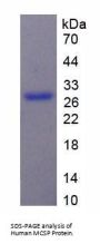 Human Melanoma Associated Chondroitin Sulfate Proteoglycan (MCSP) Protein