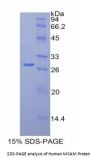 Human Melanoma Cell Adhesion Molecule (MCAM) Protein