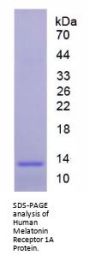 Human Melatonin Receptor 1A (MTNR1A) Protein