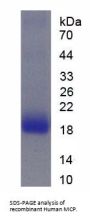 Human Membrane Cofactor Protein (MCP) Protein