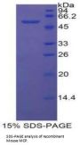 Mouse Membrane Cofactor Protein (MCP) Protein