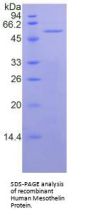 Human Mesothelin (MSLN) Protein