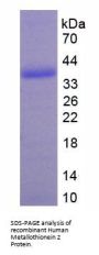 Human Metallothionein-2 (MT2A) Protein