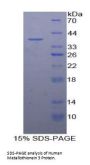 Human Metallothionein 3 (MT3) Protein
