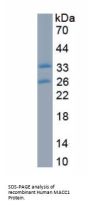 Human Metastasis Associated In Colon Cancer 1 (MACC1) Protein